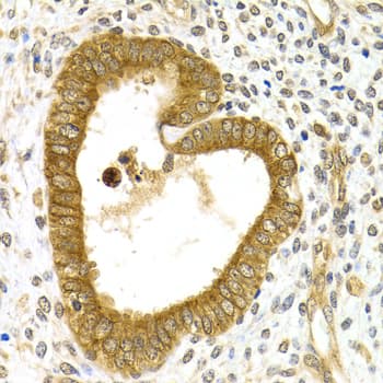 RAB27A / RAB27 Antibody