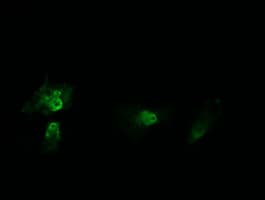 HRAS / H-Ras Antibody (clone OTI1D9)