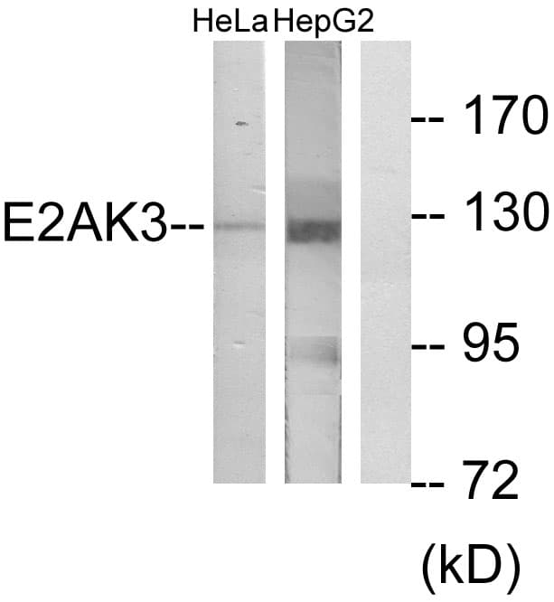 EIF2AK3 / PERK Antibody (aa61-110)