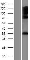 IYD Protein (Over-Expression Lysate Myc-DDK (Flag))