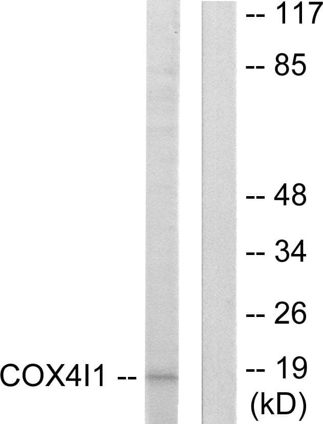 Polyclonal Rabbit anti-Human COXIV / COX4 Antibody (IHC, WB)