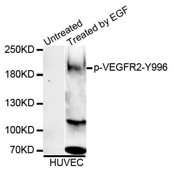 Polyclonal Rabbit anti-Human KDR / VEGFR2 / FLK1 Antibody (phospho-Tyr996, WB)
