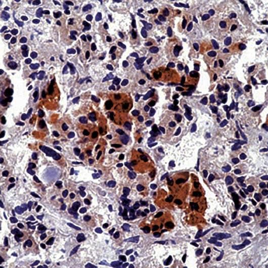 ACTH Antibody (N-Terminus, clone AH26)