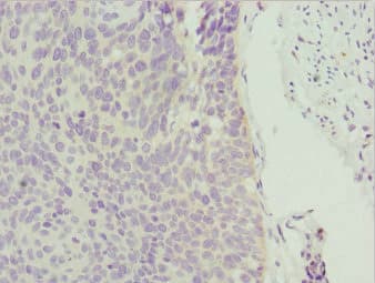 ZNF187 Antibody