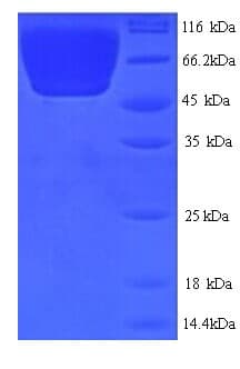 Mouse Ces1c / Carboxylesterase 1C Protein (Recombinant His)