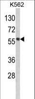 MMP19 Antibody (aa344-373)