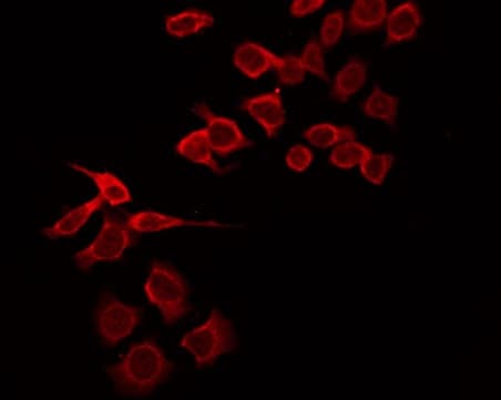 c-Kit / CD117 Antibody