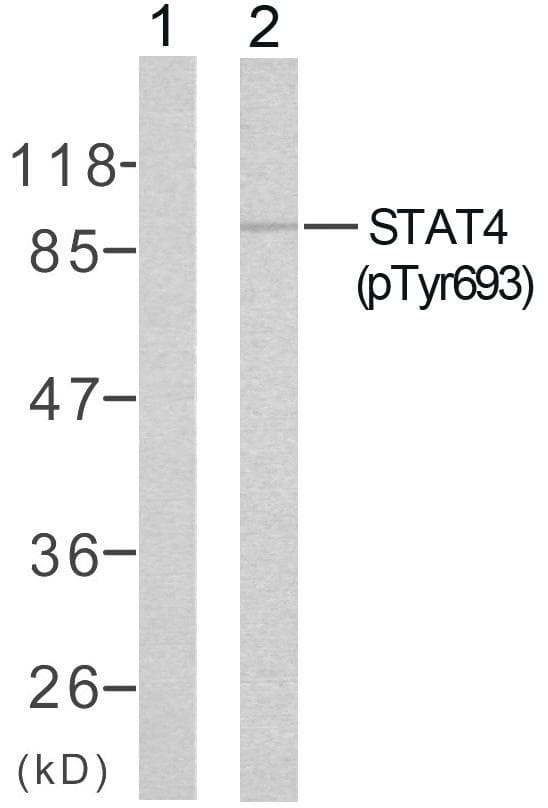 STAT4 Antibody (phospho-Tyr693)