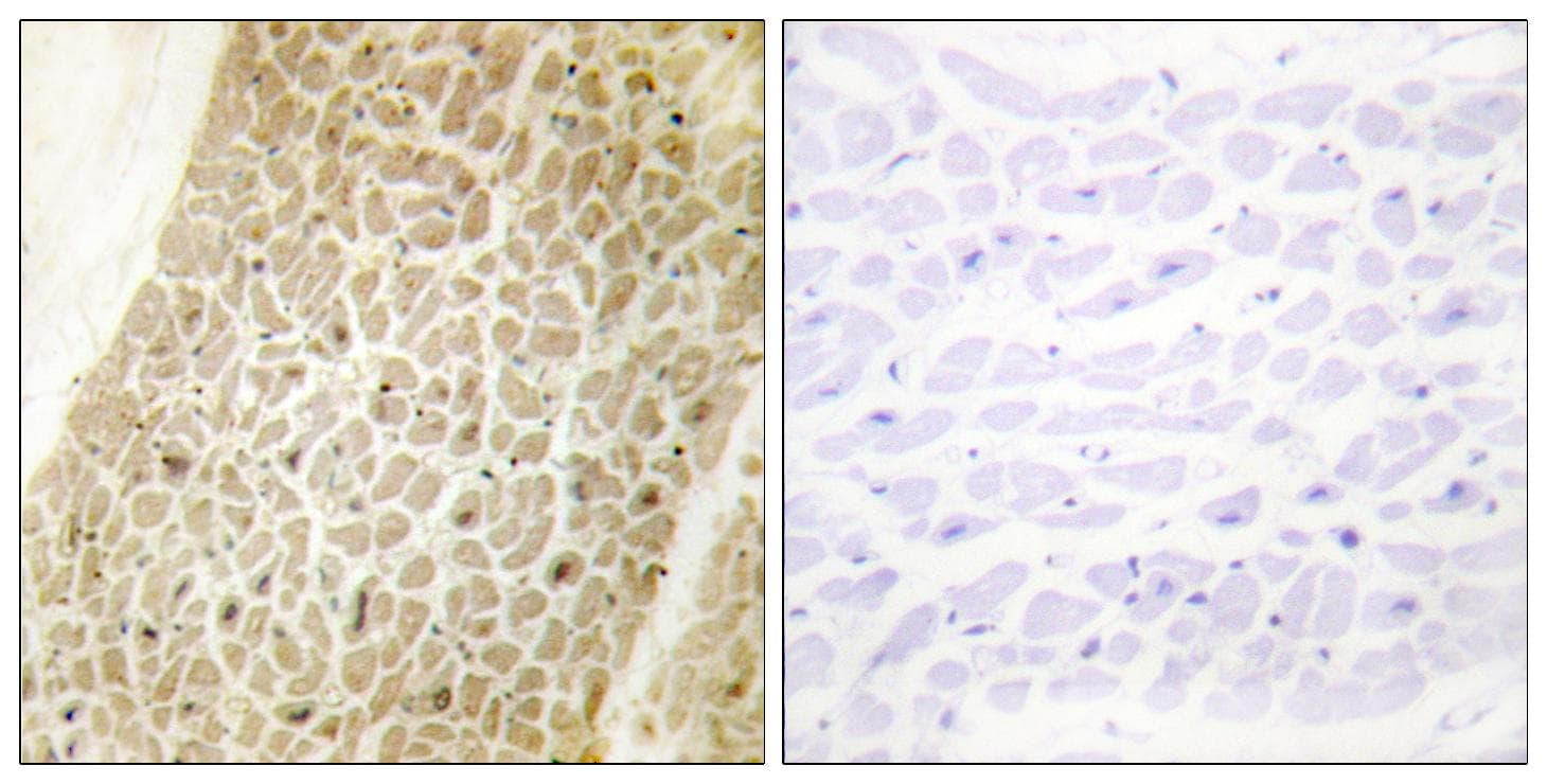 Polyclonal Rabbit anti-Human AKAP8 / AKAP95 Antibody (IHC, IF, WB)