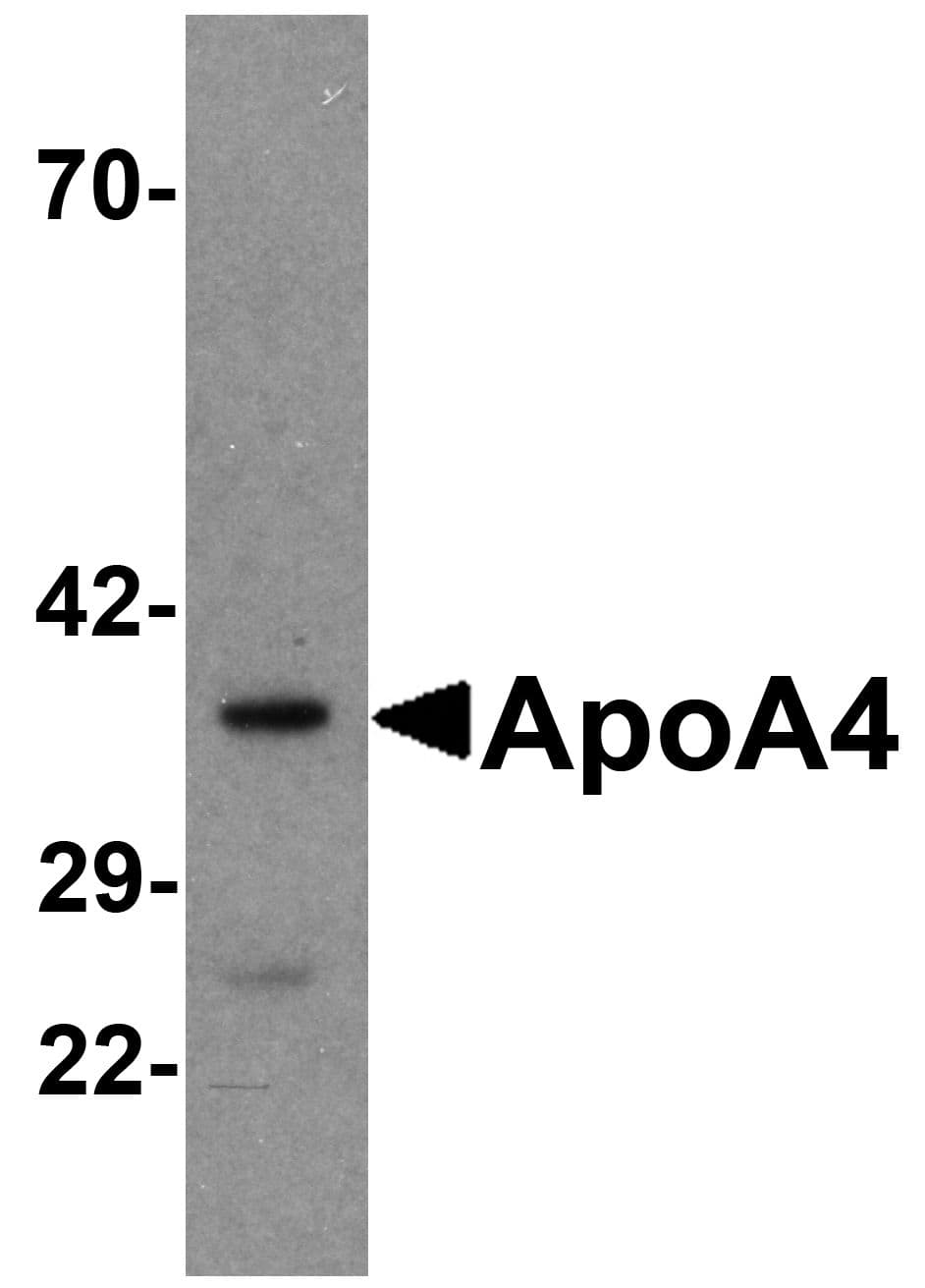 Polyclonal Rabbit anti-Human APOA4 Antibody (WB)
