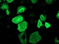 RASSF1 / RASSF1A Antibody (clone OTI2B11)