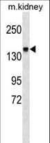 ITGA2 / CD49b Antibody (aa1152-1180)