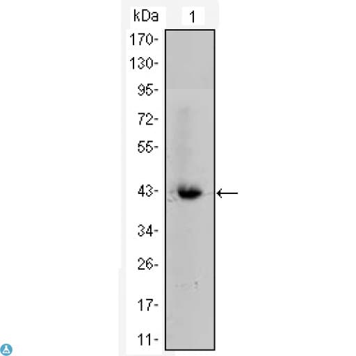 CTNNB1 / Beta Catenin Antibody
