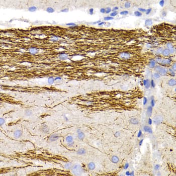 NF-L / NEFL Antibody