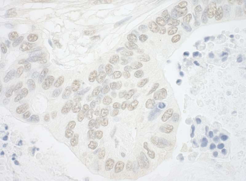 Polyclonal Rabbit anti-Human USP13 Antibody (aa750-800, IHC, WB)