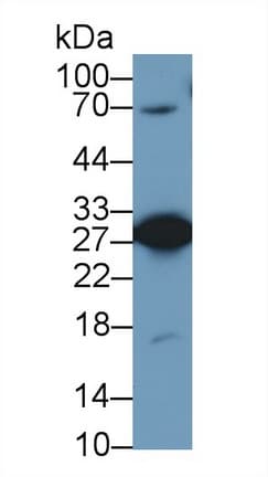 PGAM1 Antibody (aa2-254, APC)