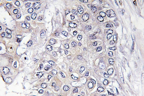 EIF4EBP1 / 4EBP1 Antibody (phospho-Thr46)