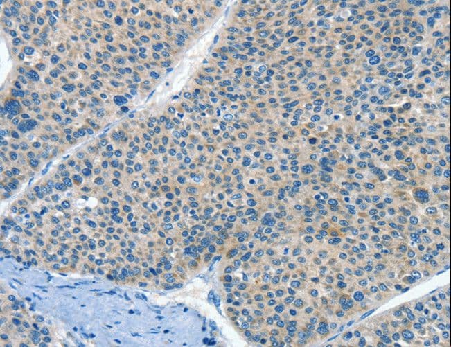 Polyclonal Rabbit anti-Human HID1 / C17orf28 Antibody (IHC)