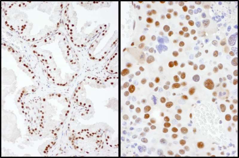 SAE2 / UBA2 Antibody (aa590-640)