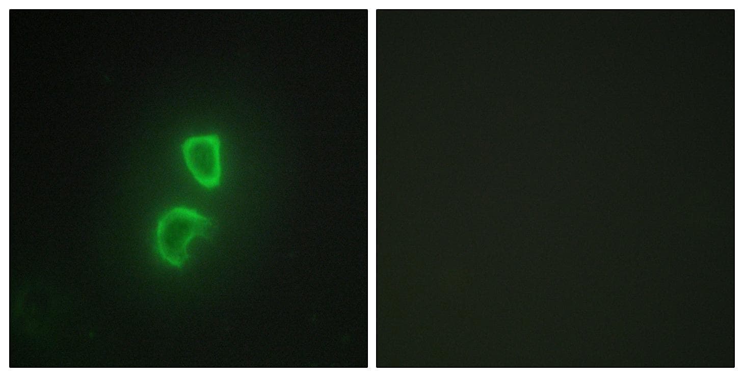 TNFSF11 / RANKL / TRANCE Antibody