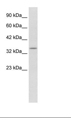KCNAB2 / Kv-Beta-2 Antibody (aa240-289)