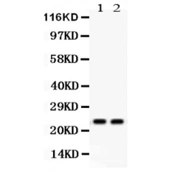 LCN2 / Lipocalin 2 / NGAL Antibody (aa21-198)