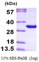 Human THYN1 / HSPC144 Protein (Recombinant His)