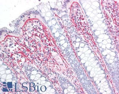 IHC-plus™ Collagen II Antibody (clone COLL-II)