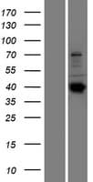 SEPT14 Protein (Over-Expression Lysate Myc-DDK (Flag))