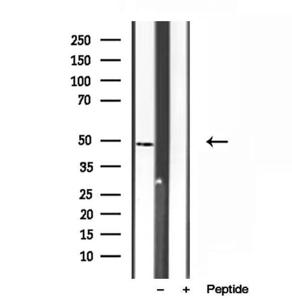 SUCLA2 Antibody