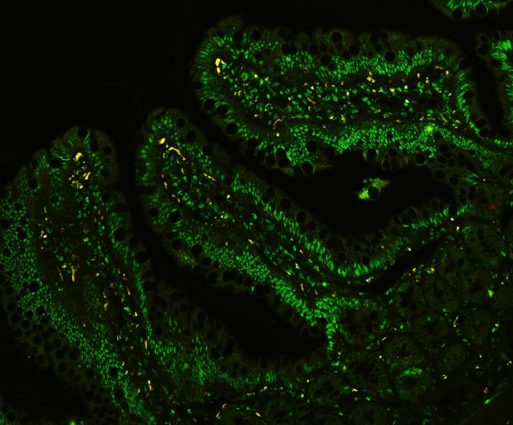 Polyclonal Rabbit anti-Human CTBP1 / CTBP Antibody (aa409-440, IHC, WB)