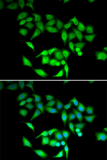 Polyclonal Rabbit anti-Human CCT3 Antibody (IHC, IF, WB)