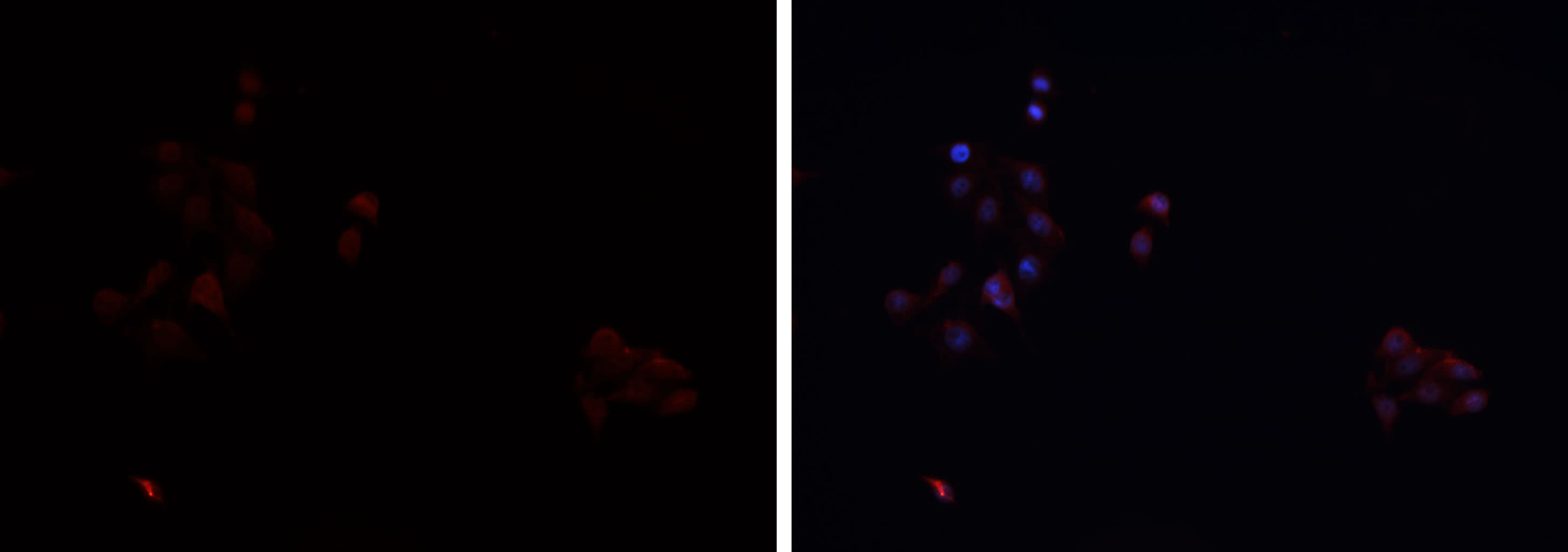 SCARB1 / SR-BI Antibody