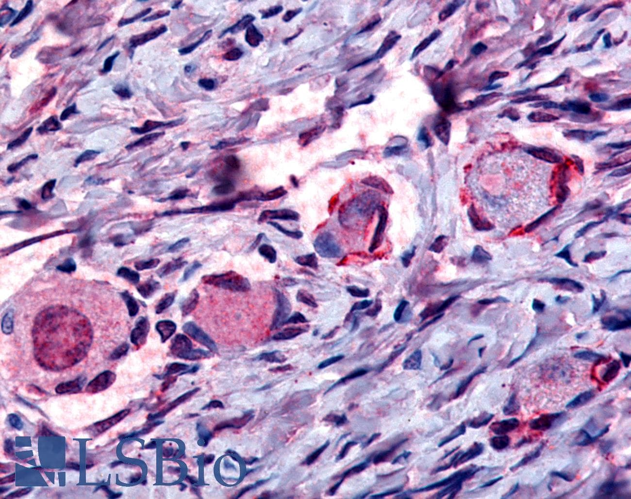 IHC-plus™ NR4A1 / NUR77 Antibody (Internal)