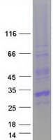 Human CITED1 Protein (Recombinant Myc-DDK (Flag))