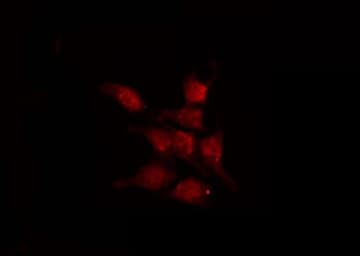 CDK2AP1 / DOC1 Antibody