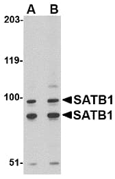 IHC-plus™ SATB1 Antibody