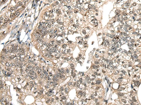 MCPH1 Antibody