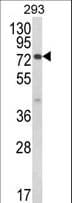 Polyclonal Rabbit anti-Human JAKMIP1 Antibody (aa270-297, IHC, WB)