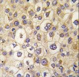 RHOE / RND3 Antibody (aa133-165)
