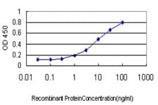 IHC-plus™ HMOX1 / HO-1 Antibody (clone 5C6)
