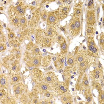 Polyclonal Rabbit anti-Human SNAI2 / SLUG Antibody (IHC, IF, WB)