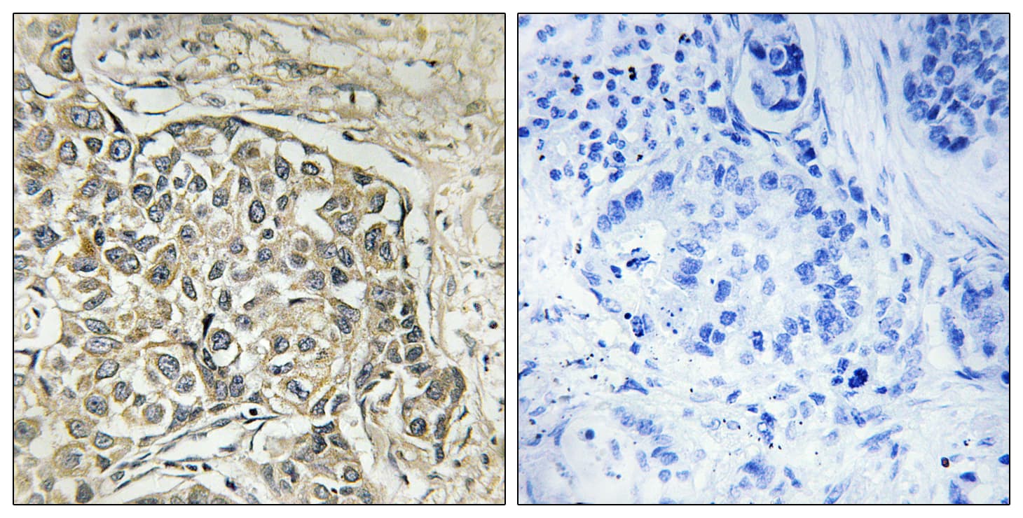 ARSD / Arylsulfatase D Antibody (aa331-380)