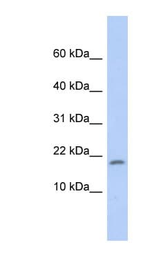 RPS15 / Ribosomal Protein S15 Antibody (C-Terminus)