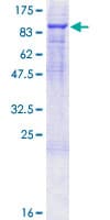 Human F2 / Prothrombin / Thrombin Protein (Recombinant GST)