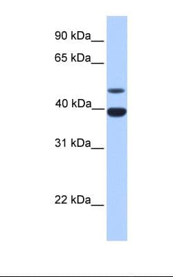 INHA / Inhibin Alpha Antibody (aa101-150, FITC)