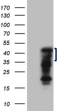 ZC3H8 Antibody (clone OTI5B12)