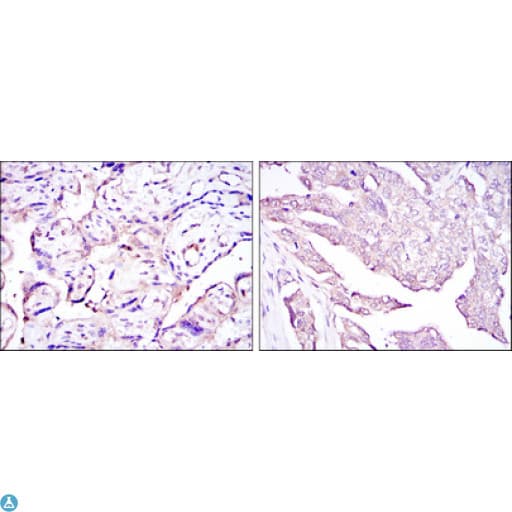 Monoclonal Mouse anti-Human HPV11 E7 Antibody (IHC, WB)