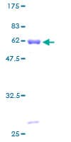 Human PDHB Protein (Recombinant GST)