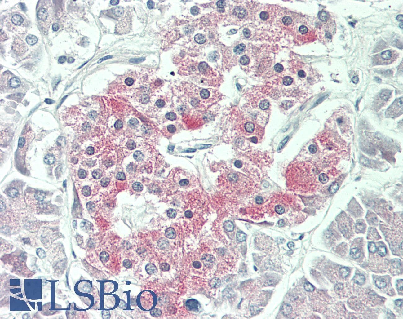 IHC-plus™ Monoclonal Mouse anti-Human ATP6V1F Antibody (clone 5F10, IHC, IF, WB)